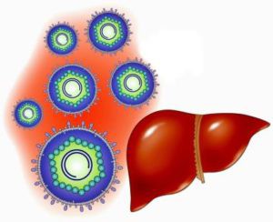 Hepatitis A