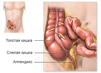 Anatomi av cecum