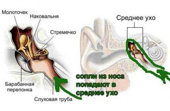 léčba zánětu středního ucha u dětí Komorowski