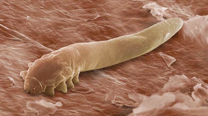 Parasites in the body