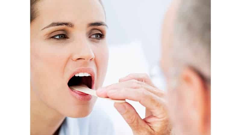 Oralna kandidijaza: liječenje odraslih