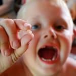Utrata zębów mlecznych u dzieci - zdjęcie