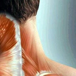 Spasms of the neck muscles. Causes and Treatment
