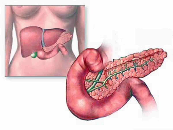 Fibrose pancreática: o que é?