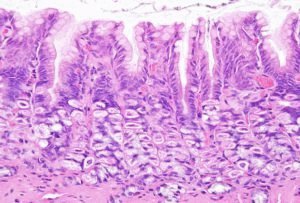 Dieet voor atrofische gastritis van de maag: menu en producten
