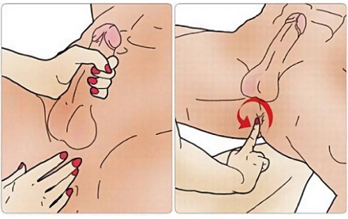 Technique for performing rectal massage 
