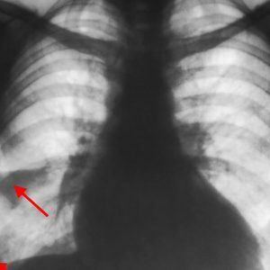 Kt-and-x-ray diagnostics-violations-lung-blood circulation( 24)( 1)
