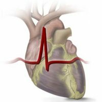 Insuficiência cardíaca crônica