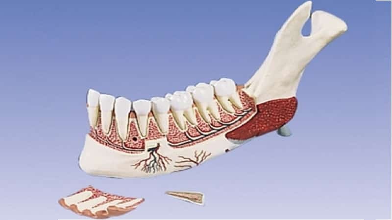 Osteomielite da mandíbula: sintomas, tratamento, odontogenic, crônica, fotos