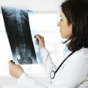 X-ray-abdominal cavity