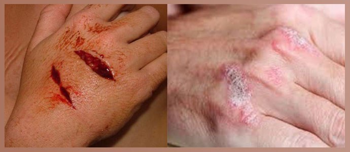 Skär och sår, dermatologiska problem