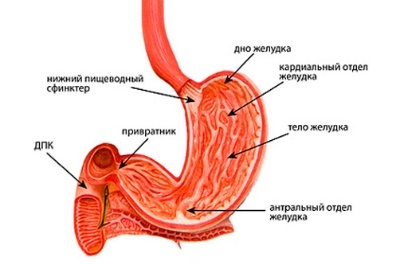Gastrite focal - lesão do local da mucosa gástrica