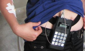 Duodeno-maagreflux: oorzaken, symptomen, diagnose en behandeling