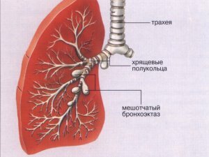 bronchiectasiával