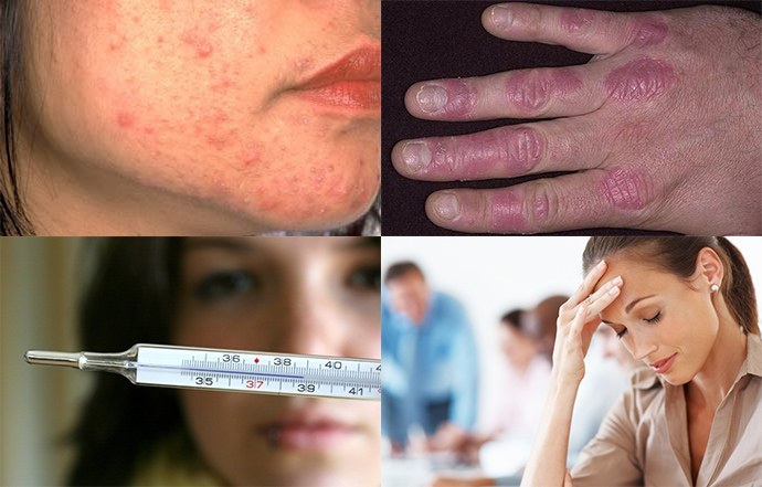 a krónikus dermatitisz gyakori jelei