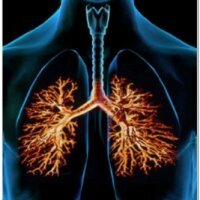 Exacerbation of chronic bronchitis