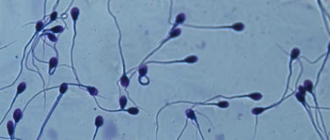 Agglutination von Spermatozoen