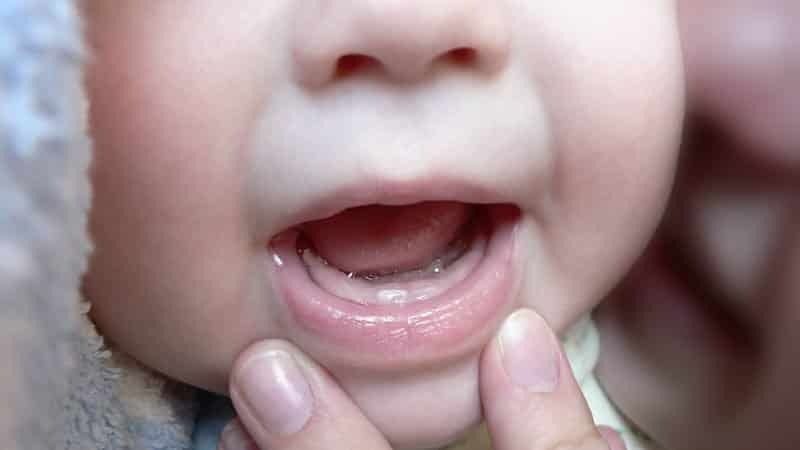bébé 9 mois sans dents