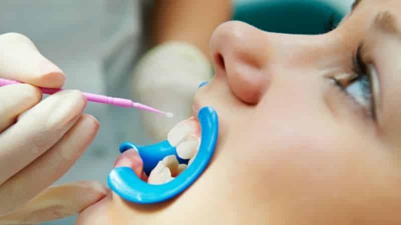 Zahnpasta Wiederherstellung des Zahnschmelzes