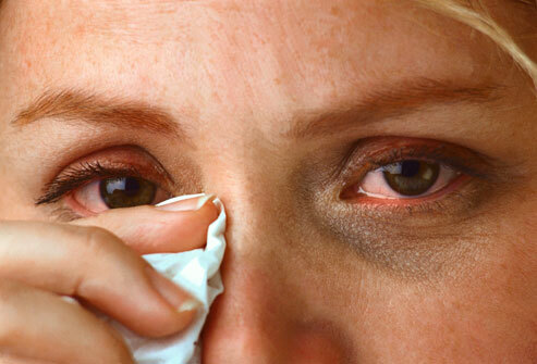 Alergia ao olho