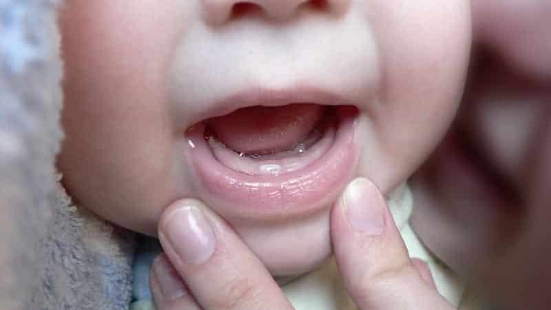 Como crescer dentes em crianças
