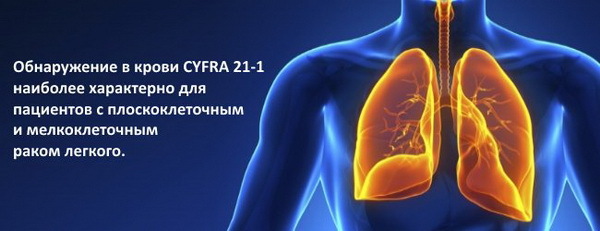 Tumorski markeri CYFRA 21-1