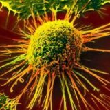 The use of homeopathy in oncology