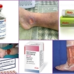 Producten voor de behandeling van veneuze beenzweren