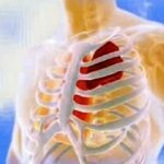 Contusion-chest-cells