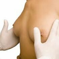 Fat involution of the mammary gland