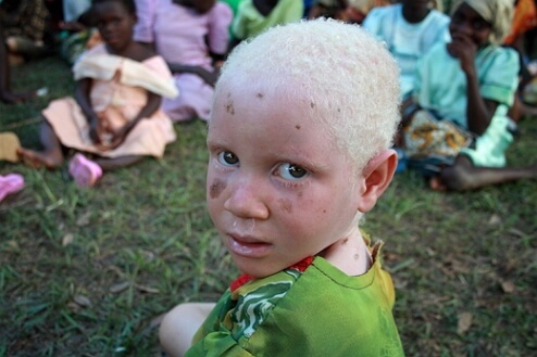 Černá albínová fotografie