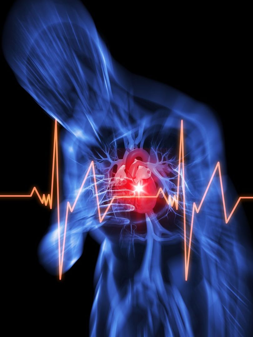 Iznenadni srčani zastoj: uzroci, znakovi, simptomi, prva pomoć