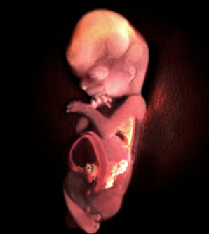 12 Woche Schwangerschaftsfoto