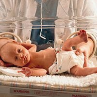 Catamnesis pada bayi prematur