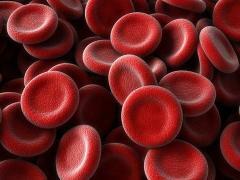 krvné zrazeniny, príčiny
