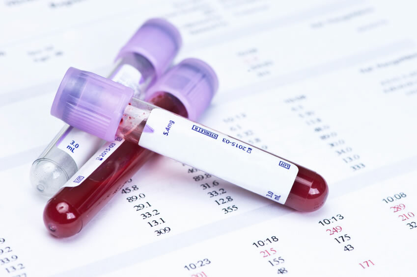 Analyse van de bloedsuikerspiegel: voorbereiding, de interpretatie van de resultaten