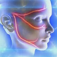 Inflammation of the facial nerve