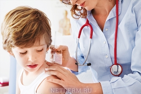 Hur manifesterar rubella hos barn - de viktigaste symptomen och terapierna