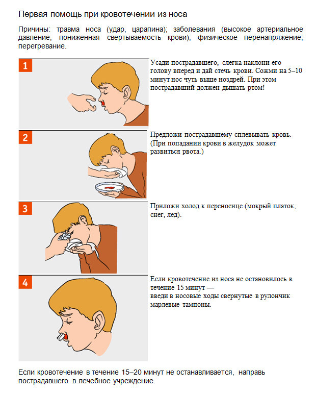 Emergency care for nasal bleeding