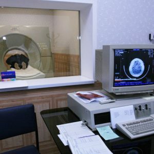 Kompjutorizirana tomografija mozga 1