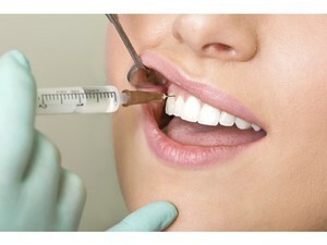Doziranje in linkomicin odmerek v zobozdravstvu