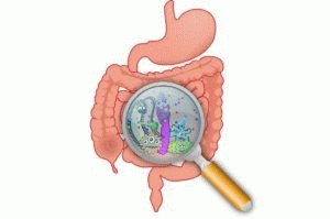 Intestinal dysbiose