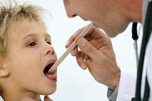 Liječnik koji pregledava dijete iz bilo kojeg razloga mora nužno procijeniti stanje jezika i usne šupljine u cjelini.