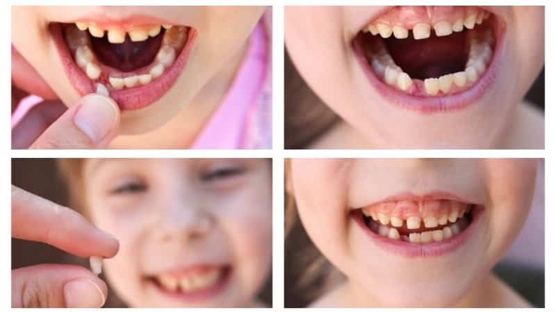 mlečni zob odvijanje z obdelavo otroka