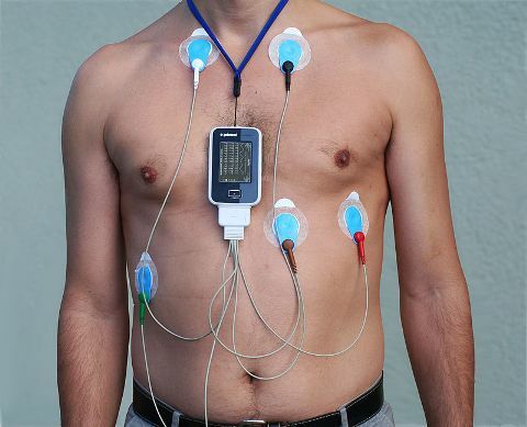 Dnevni Holter EKG spremljanje: Podatki in funkcije